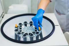Platelet-Rich plasma preparation. Tube with blood in hands. Centrifuge. Background