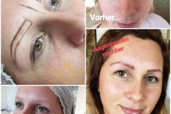 Microblading